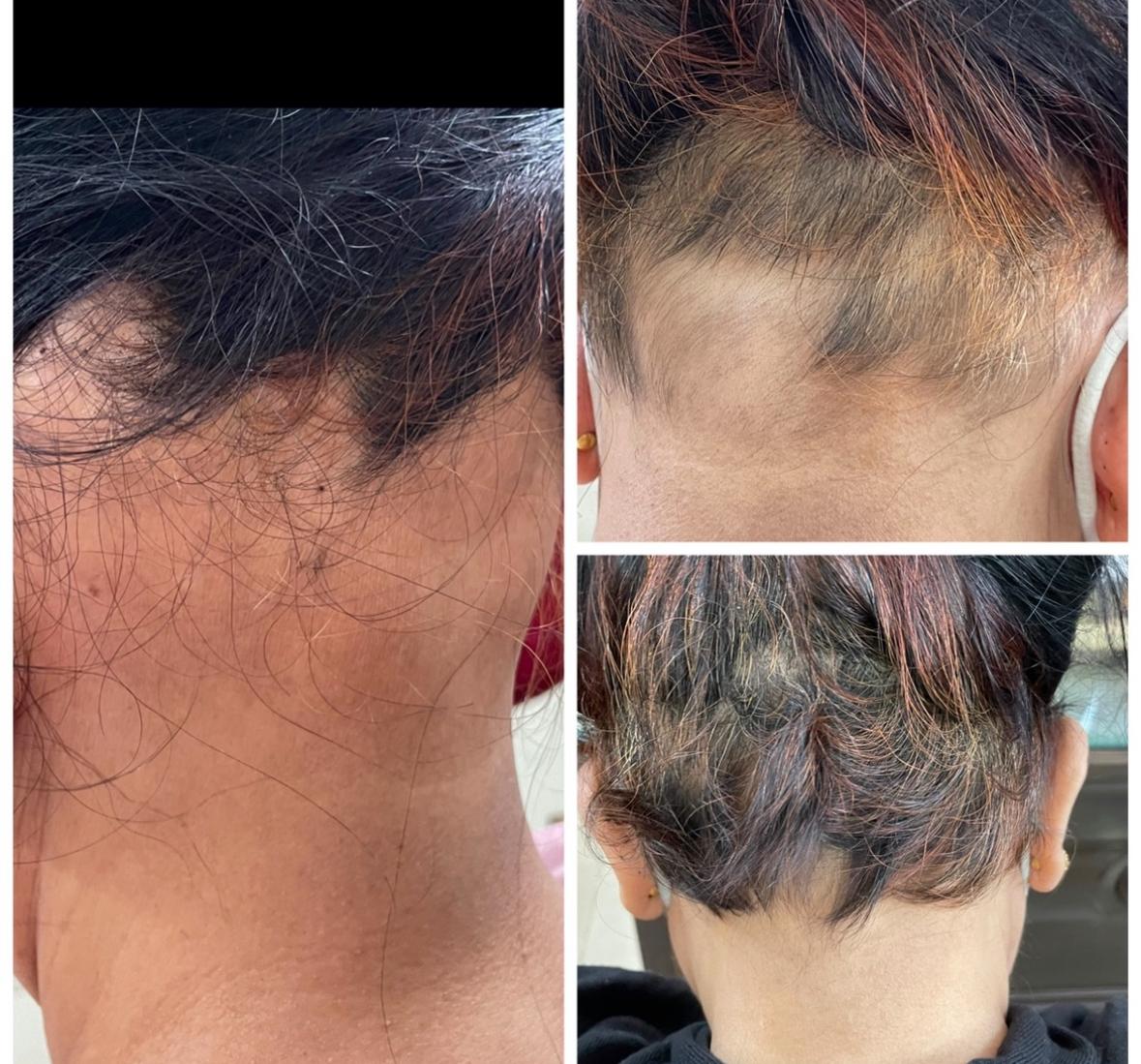 Before and After Treatment 3