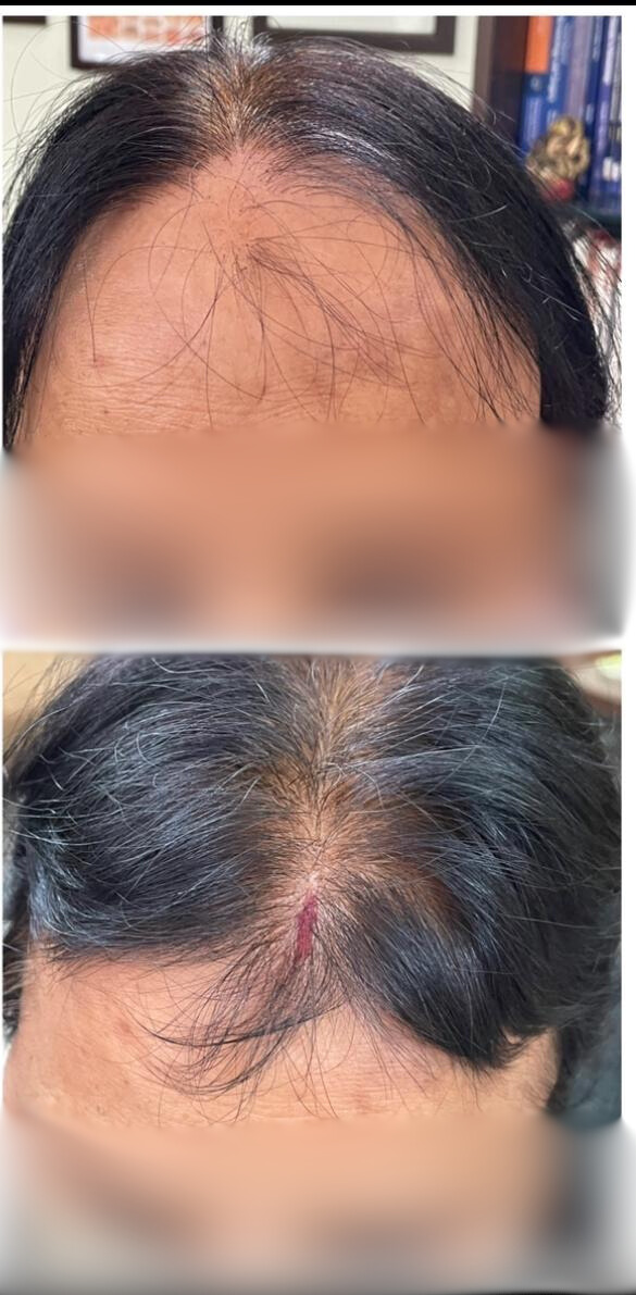 Before and After Treatment 3