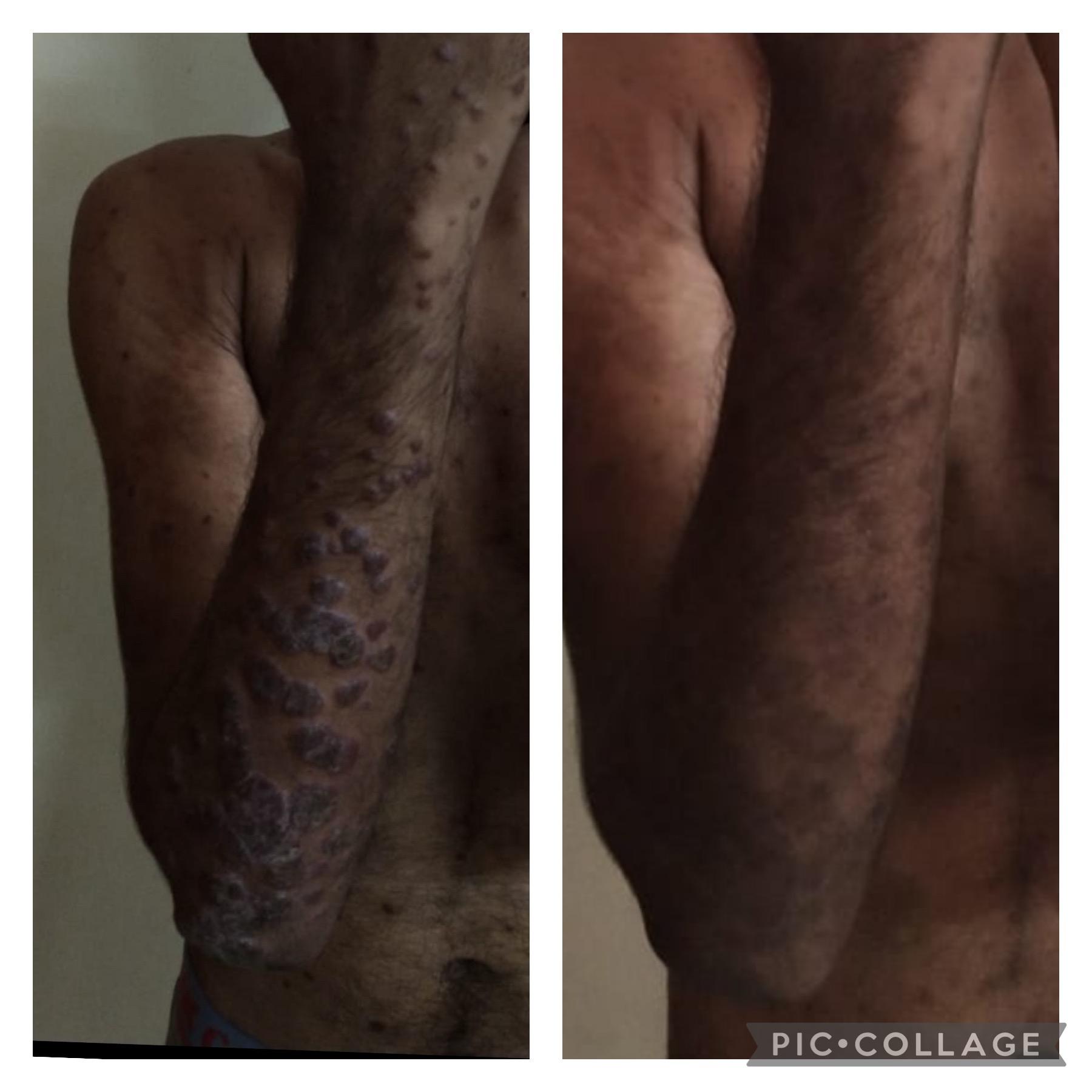 Before and After Treatment 3